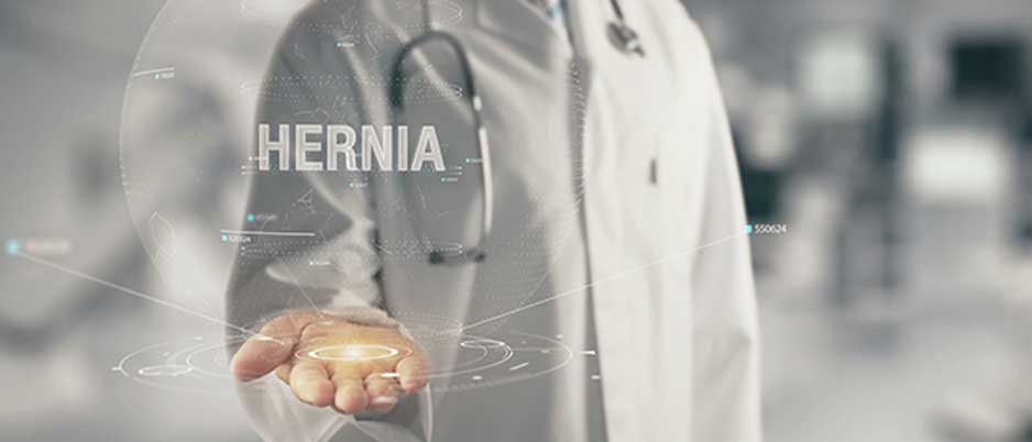 Incisional-Hernia-Los-Angeles-Hemorrhoid-Clinic