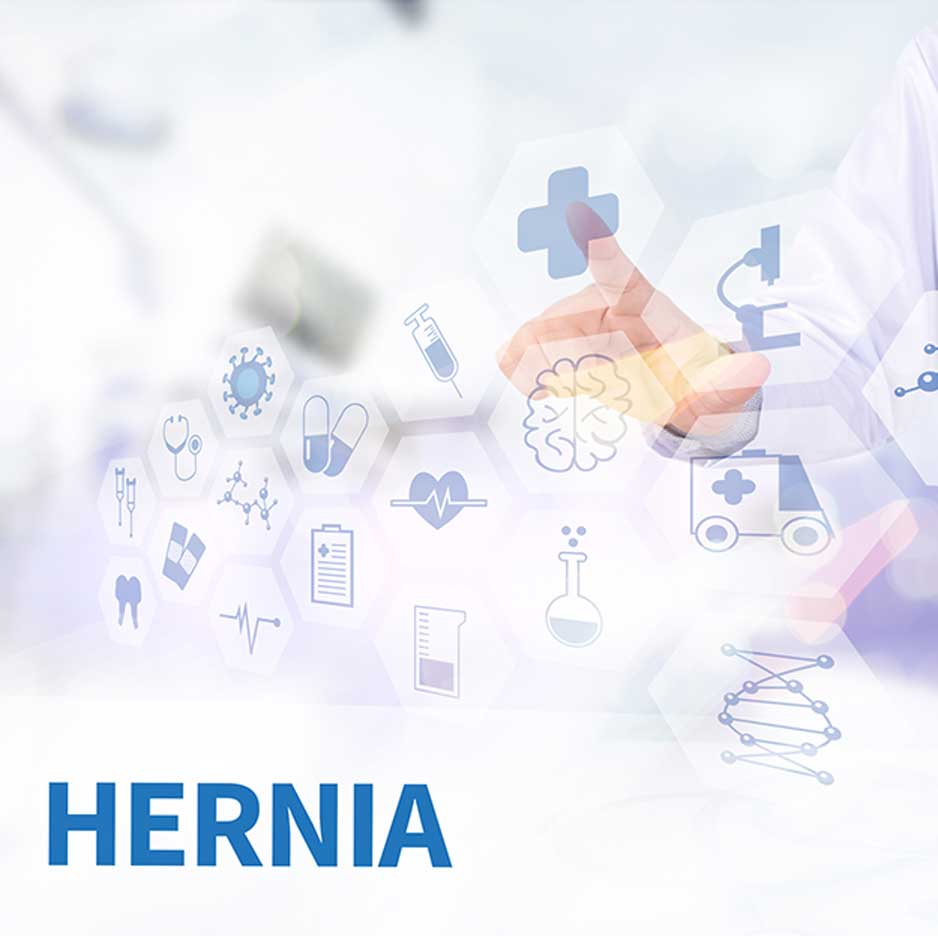 Spigelian-Hernia-Los-Angeles-Hemorrhoid-Clinic