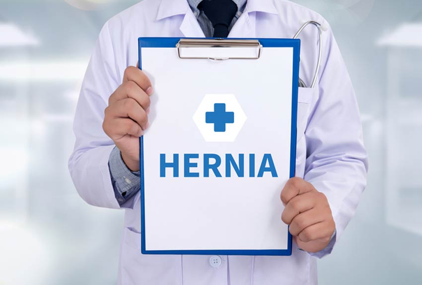 Umbilical-Hernia-Los-Angeles-Hemorrhoid-Clinic